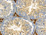 RALBP1 Antibody in Immunohistochemistry (Paraffin) (IHC (P))