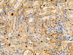 RALBP1 Antibody in Immunohistochemistry (Paraffin) (IHC (P))