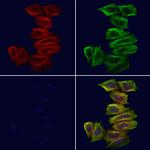 TRADD Antibody in Immunocytochemistry (ICC/IF)