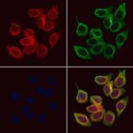 KCNE1 Antibody in Immunocytochemistry (ICC/IF)