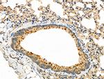 KCNE1 Antibody in Immunohistochemistry (Paraffin) (IHC (P))