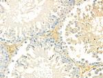 NCF2 Antibody in Immunohistochemistry (Paraffin) (IHC (P))