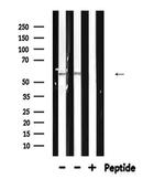 NCF2 Antibody in Western Blot (WB)