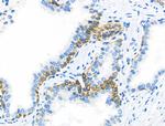 ABO Antibody in Immunohistochemistry (Paraffin) (IHC (P))