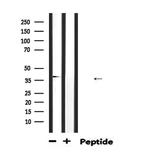 ABO Antibody in Western Blot (WB)