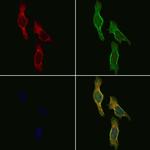 Protein S Antibody in Immunocytochemistry (ICC/IF)