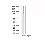 Protein S Antibody in Western Blot (WB)