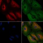 HMGCR Antibody in Immunocytochemistry (ICC/IF)