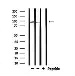 HMGCR Antibody in Western Blot (WB)