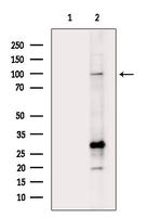 HMGCR Antibody in Western Blot (WB)