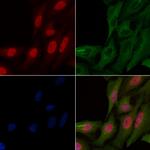 BTRC Antibody in Immunocytochemistry (ICC/IF)