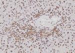 BTRC Antibody in Immunohistochemistry (Paraffin) (IHC (P))