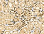 BTRC Antibody in Immunohistochemistry (Paraffin) (IHC (P))