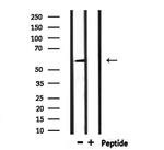 UGT1A9 Antibody in Western Blot (WB)