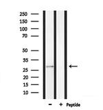 MPZ Antibody in Western Blot (WB)