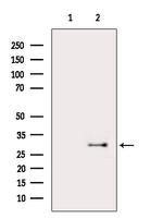 MPZ Antibody in Western Blot (WB)