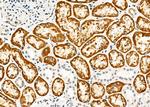 SCNN1B Antibody in Immunohistochemistry (Paraffin) (IHC (P))