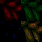 AKR1C3 Antibody in Immunocytochemistry (ICC/IF)