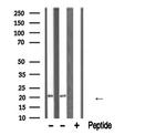 ATF3 Antibody in Western Blot (WB)