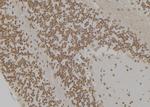 HSP701L Antibody in Immunohistochemistry (Paraffin) (IHC (P))