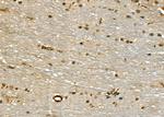 HSP701L Antibody in Immunohistochemistry (Paraffin) (IHC (P))