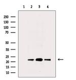 PRDX2 Antibody in Western Blot (WB)