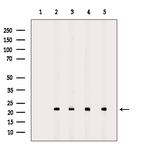 PRDX2 Antibody in Western Blot (WB)