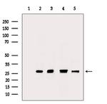 PRDX2 Antibody in Western Blot (WB)