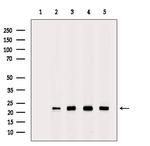 PRDX2 Antibody in Western Blot (WB)