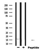 DLC1 Antibody in Western Blot (WB)