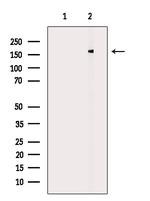 DLC1 Antibody in Western Blot (WB)