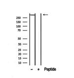 DST Antibody in Western Blot (WB)