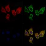 CDKN3 Antibody in Immunocytochemistry (ICC/IF)