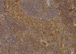 CDKN3 Antibody in Immunohistochemistry (Paraffin) (IHC (P))