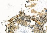 CDKN3 Antibody in Immunohistochemistry (Paraffin) (IHC (P))