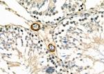 CDKN3 Antibody in Immunohistochemistry (Paraffin) (IHC (P))