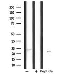 CDKN3 Antibody in Western Blot (WB)