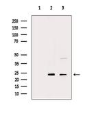 CDKN3 Antibody in Western Blot (WB)