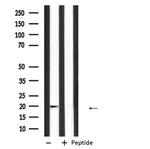 IGF2 Antibody in Western Blot (WB)