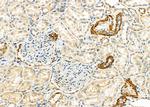 E-selectin Antibody in Immunohistochemistry (Paraffin) (IHC (P))