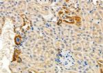 E-selectin Antibody in Immunohistochemistry (Paraffin) (IHC (P))