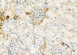 E-selectin Antibody in Immunohistochemistry (Paraffin) (IHC (P))