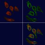 E-selectin Antibody in Immunocytochemistry (ICC/IF)