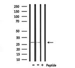 CD16 Antibody in Western Blot (WB)