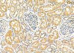 CPT2 Antibody in Immunohistochemistry (Paraffin) (IHC (P))