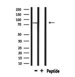 CPT2 Antibody in Western Blot (WB)