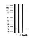 KISS1 Antibody in Western Blot (WB)