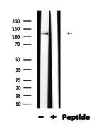 Nephrin Antibody in Western Blot (WB)