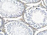 PDX1 Antibody in Immunohistochemistry (Paraffin) (IHC (P))