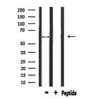 ATL1 Antibody in Western Blot (WB)